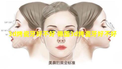 3d烤瓷牙好不好 德国3d烤瓷牙好不好